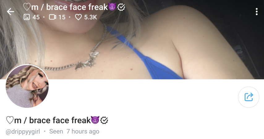 brace face freak Drippy Girl OnlyFans