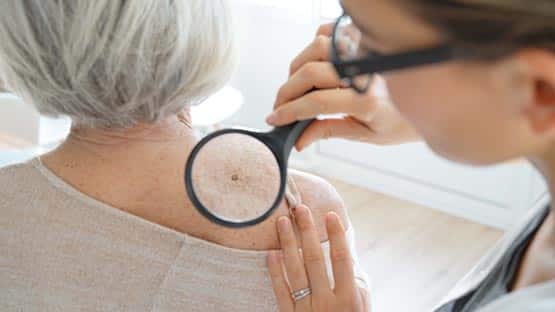 doctor checking senior patient skin