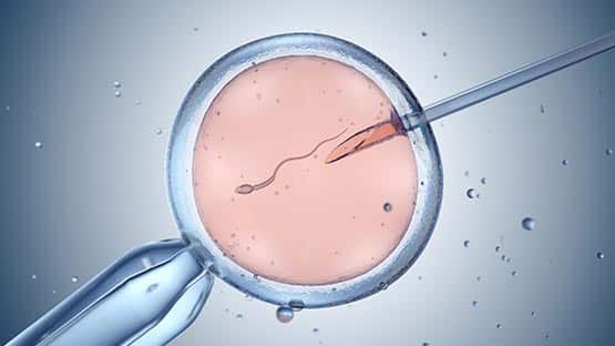 IVF in vitro fertilization graphic