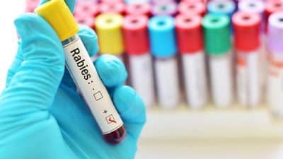 positive rabies test