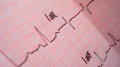 heart cardiovascular test chart peptide Hexarelin