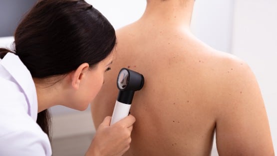 skin cancer